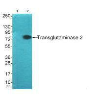 Western blot analysis of extracts from HuvEc  cells (Lane 2), using Transglutaminase 2 antiobdy. The lane on the left is treated with systhesized peptide.Rabbit anti-Human TGM2 Polyclonal Antibody