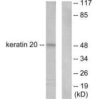 Western blot analysis of extracts from HeLa cells, using Keratin 20 antibody.