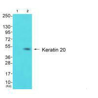 Western blot analysis of extracts from HepG2 cells (Lane 2), using Keratin 20 antiobdy. The lane on the left is treated with synthesized peptide.