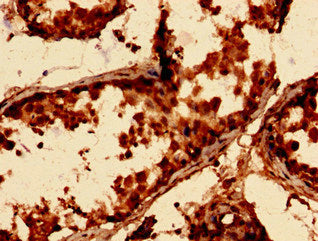 Immunohistochemistry analysis of human testis tissue using ARPC3 Antibody at dilution of 1:100Rabbit anti-Human ARPC3 Polyclonal Antibody