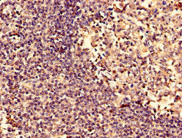 Immunohistochemistry analysis of human tonsil tissue using ARPC3 Antibody at dilution of 1:100Rabbit anti-Human ARPC3 Polyclonal Antibody