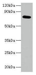Western blot  | All lanes: ARPC3 antibody at 2µg/ml + 293T whole cell lysate  | Secondary  | Goat polyclonal to rabbit IgG at 1/15000 dilution  | Predicted band size: 21 kDa  | Observed band size: 75 kDaRabbit anti-Human ARPC3 Polyclonal Antibody