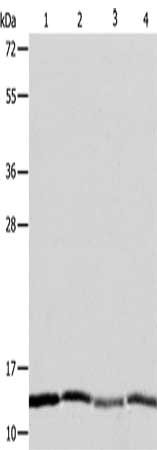 Gel: 10+12+15%SDS-PAGE, Lysate: 40 μg, Lane 1-4: Hela cells, Jurkat cells, MCF7 cells, A431 cells, Primary antibody: ATPIF1 Antibody(ATPIF1 Antibody) at dilution 1/1350, Secondary antibody: Goat anti rabbit IgG at 1/8000 dilution, Exposure time: 1 minute