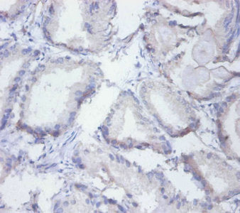 Immunohistochemistry of paraffin-embedded human prostate tissue using SYNCRIP Antibody at dilution of 1:100Rabbit anti-Human SYNCRIP Polyclonal Antibody
