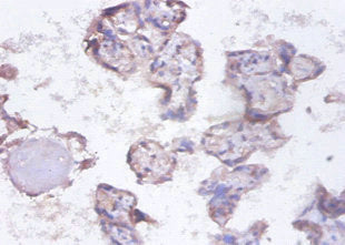Immunohistochemistry of paraffin-embedded human placenta tissue using SYNCRIP Antibody at dilution of 1:100Rabbit anti-Human SYNCRIP Polyclonal Antibody
