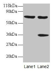 Western blot  | All lanes: SYNCRIP antibody at 2µg/ml  | Lane 1: EC109 whole cell lysate  | Lane 2: 293T whole cell lysate  | Secondary  | Goat polyclonal to rabbit IgG at 1/15000 dilution  | Predicted band size: 70, 66, 63, 59, 47 kDa  | Observed band size: 70, 36 kDaRabbit anti-Human SYNCRIP Polyclonal Antibody