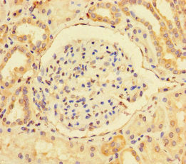 Immunohistochemistry of paraffin-embedded human kidney tissue using BMI1 Antibody at dilution of 1:100