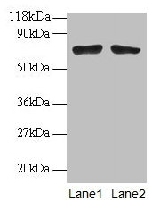 Western blot  | All lanes: BMI1 antibodyt 2µg/ml  | Lane 1: EC109 whole cell lysate  | Lane 2: 293T whole cell lysate  | Secondary  | Goat polyclonal to rabbit IgG at 1/15000 dilution  | Predicted band size: 37 kDa  | Observed band size: 70 kDa