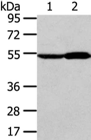 Gel: 6%SDS-PAGE, Lysate: 40 μg, Lane 1-2: Human fetal liver and normal liver tissue, Primary antibody: ALDH3A2 Antibody(ALDH3A2 Antibody) at dilution 1/250 dilution, Secondary antibody: Goat anti rabbit IgG at 1/8000 dilution, Exposure time: 10 secondsRabbit anti-Human ALDH3A2 Polyclonal Antibody