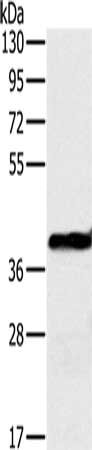 Gel: 8%SDS-PAGE, Lysate: 40 μg, Lane: Mouse liver tissue, Primary antibody: OTC Antibody(OTC Antibody) at dilution 1/650, Secondary antibody: Goat anti rabbit IgG at 1/8000 dilution, Exposure time: 1 secondRabbit anti-Human OTC Polyclonal Antibody