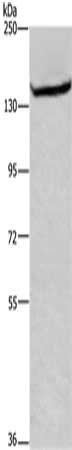 Gel: 6%SDS-PAGE, Lysate: 40 μg, Lane: Mouse skeletal muscle tissue, Primary antibody: ITGA11 Antibody(ITGA11 Antibody) at dilution 1/200, Secondary antibody: Goat anti rabbit IgG at 1/8000 dilution, Exposure time: 3 minutes