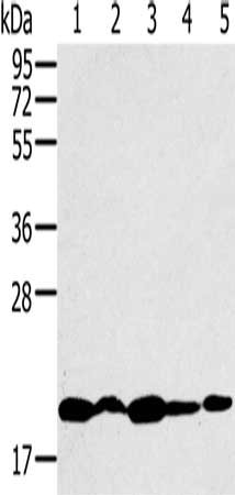 Gel: 10%SDS-PAGE, Lysate: 40 μg, Lane 1-5: K562 cells, 231 cells, Jurkat cells, hela cells, 293T cells, Primary antibody: RNF5 Antibody(RNF5 Antibody) at dilution 1/200, Secondary antibody: Goat anti rabbit IgG at 1/8000 dilution, Exposure time: 3 minutesRabbit anti-Human RNF5 Polyclonal Antibody