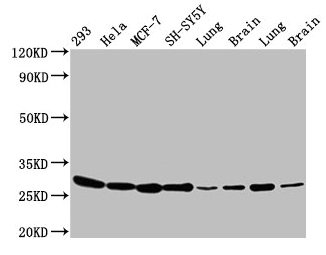 Western Blot  | Positive WB detected in: 293 whole cell lysate, Hela whole cell lysate, MCF-7 whole cell lysate, SH-SY5Y whole cell lysate, Rat lung tissue, Rat brain tissue, Mouse lung tissue, Mouse brain tissue  | All lanes: BCAP31 antibody at 4.8µg/ml  | Secondary  | Goat polyclonal to rabbit IgG at 1/50000 dilution  | Predicted band size: 28, 35 kDa  | Observed band size: 28 kDa