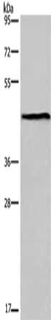 Gel: 8%SDS-PAGE, Lysate: 40 μg, Lane: Mouse lung tissue, Primary antibody: ESRRG Antibody(ESRRG Antibody) at dilution 1/300, Secondary antibody: Goat anti rabbit IgG at 1/8000 dilution, Exposure time: 40 secondsRabbit anti-Human ESRRG Polyclonal Antibody