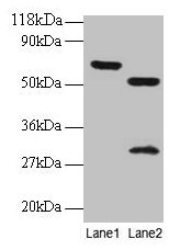 Western blot  | All lanes: ZNF384 antibody at 2µg/ml  | Lane 1: EC109 whole cell lysate  | Lane 2: 293T whole cell lysate  | Secondary  | Goat polyclonal to rabbit IgG at 1/15000 dilution  | Predicted band size: 64, 57, 51 kDa  | Observed band size: 64, 51, 30 kDa
