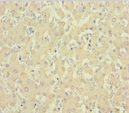 Immunohistochemistry of paraffin-embedded human liver tissue using C1D Antibody at dilution of 1:100