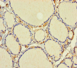Immunohistochemistry of paraffin-embedded human thyroid tissue using C1D Antibody at dilution of 1:100