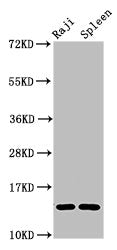 Western Blot  | Positive WB detected in: Raji whole cell lysate, Rat spleen tissue  | All lanes: GABARAPL2 antibody at 4µg/ml  | Secondary  | Goat polyclonal to rabbit IgG at 1/50000 dilution  | Predicted band size: 14 kDa  | Observed band size: 14 kDaRabbit anti-Human GABARAPL2 Polyclonal Antibody
