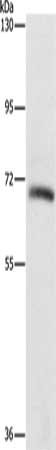 Gel: 6%SDS-PAGE, Lysate: 40 μg, Lane: Lovo cells, Primary antibody: KLC1 Antibody(KLC1 Antibody) at dilution 1/550, Secondary antibody: Goat anti rabbit IgG at 1/8000 dilution, Exposure time: 5 secondsRabbit anti-Human KLC1 Polyclonal Antibody
