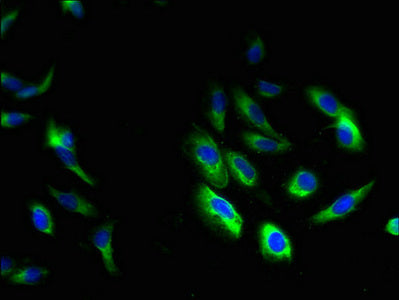 Immunofluorescent analysis of Hela cells using HAX1 Antibody at dilution of 1:100 and Alexa Fluor 488-congugated AffiniPure Goat Anti-Rabbit IgG(H+L)Rabbit anti-Human HAX1 Polyclonal Antibody