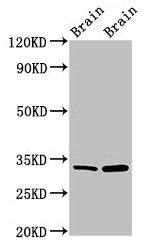 Western Blot  | Positive WB detected in: Mouse brain tissue, Rat brain tissue  | All lanes: HAX1 antibody at 1.5µg/ml  | Secondary  | Goat polyclonal to rabbit IgG at 1/50000 dilution  | Predicted band size: 32, 33, 29, 15, 27, 22 kDa  | Observed band size: 32 kDaRabbit anti-Human HAX1 Polyclonal Antibody
