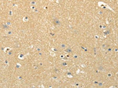 The image on the left is immunohistochemistry of paraffin-embedded Human brain tissue using the antibody Antibody) at dilution 1/30, on the right is treated with synthetic peptide. (Original magnification: ×200)Rabbit anti-Human MSI1 Polyclonal Antibody