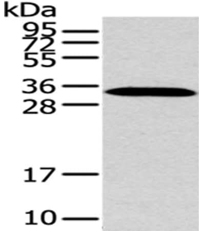 Gel: 12%SDS-PAGE,Lysate: 40 μg,,Primary antibody: MSI1 Antibody(MSI1 Antibody) at dilution 1/200 dilution,Secondary antibody: Goat anti rabbit IgG at 1/8000 dilution,Exposure time: 5 minutesRabbit anti-Human MSI1 Polyclonal Antibody