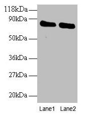 Western blot  | All lanes: OTUB1 antibody at 2µg/ml  | Lane 1: EC109 whole cell lysate  | Lane 2: 293T whole cell lysate  | Secondary  | Goat polyclonal to rabbit IgG at 1/15000 dilution  | Predicted band size: 32, 36 kDa  | Observed band size: 80 kDaRabbit anti-Human OTUB1 Polyclonal Antibody