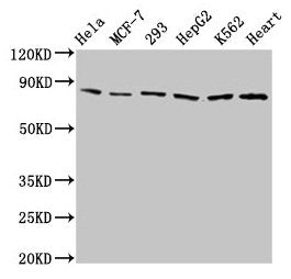 Western Blot  | Positive WB detected in: Hela whole cell lysate, MCF-7 whole cell lysate, 293 whole cell lysate, HepG2 whole cell lysate, K562 whole cell lysate, Mouse heart tissue  | All lanes: TRAP1 antibody at 2µg/ml  | Secondary  | Goat polyclonal to rabbit IgG at 1/50000 dilution  | Predicted band size: 81, 75 kDa  | Observed band size: 81 kDaRabbit anti-Human TRAP1 Polyclonal Antibody