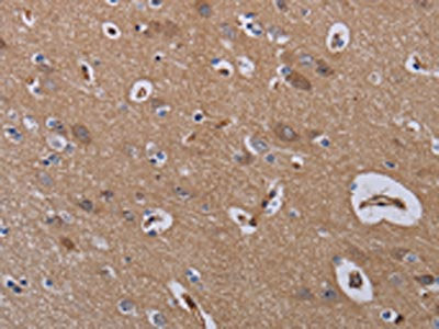 The image on the left is immunohistochemistry of paraffin-embedded Human brain  tissue using ZC3H12A Antibody(ZC3H12A Antibody) at dilution 1/40, on the right is treated with fusion protein. (Original magnification: ×200)Rabbit anti-Human ZC3H12A Polyclonal Antibody