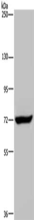 Gel: 6%SDS-PAGE, Lysate: 40 μg, Lane: K562 cells, Primary antibody: ZC3H12A Antibody(ZC3H12A Antibody) at dilution 1/200, Secondary antibody: Goat anti rabbit IgG at 1/8000 dilution, Exposure time: 20 secondsRabbit anti-Human ZC3H12A Polyclonal Antibody
