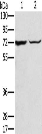 Gel: 8%SDS-PAGE, Lysate: 40 μg, Lane 1-2: Mouse liver tissue, hepg2 cells, Primary antibody: SLC25A13 Antibody(SLC25A13 Antibody) at dilution 1/450, Secondary antibody: Goat anti rabbit IgG at 1/8000 dilution, Exposure time: 20 secondsRabbit anti-Human SLC25A13 Polyclonal Antibody