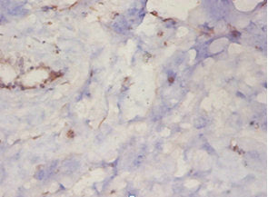 Immunohistochemistry of paraffin-embedded human mammary gland tissue using PARK7 Antibody at dilution of 1:50Rabbit anti-Human PARK7 Polyclonal Antibody