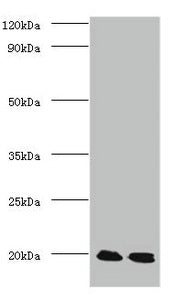 Western blot | All lanes: Protein DJ-1 antibody at 2μg/ml | Lane 1: EC109 whole cell lysate | Lane 2: 293T whole cell lysate | Secondary | Goat polyclonal to Rabbit IgG at 1/15000 dilution | Predicted band size: 20 kDa | Observed band size: 20 kDaRabbit anti-Human PARK7 Polyclonal Antibody