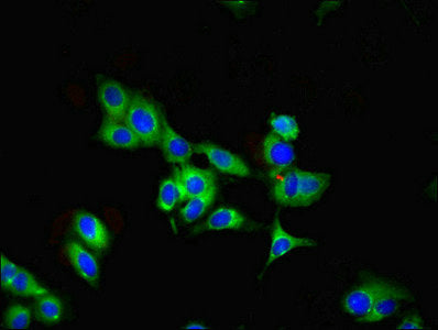Immunofluorescent analysis of Hela cells using PARK7 Antibody at dilution of 1:100 and Alexa Fluor 488-congugated AffiniPure Goat Anti-Rabbit IgG(H+L)Rabbit anti-Human PARK7 Polyclonal Antibody