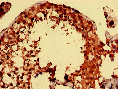 Immunohistochemistry analysis of human testis tissue using the antibody at dilution of 1:100Rabbit anti-Human PARK7 Polyclonal Antibody