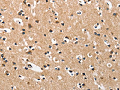 The image on the left is immunohistochemistry of paraffin-embedded Human brain  tissue using DKK3 Antibody(DKK3 Antibody) at dilution 1/50, on the right is treated with fusion protein. (Original magnification: ×200)Rabbit anti-Human DKK3 Polyclonal Antibody