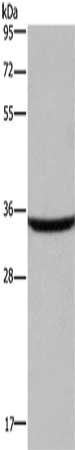Gel: 8%SDS-PAGE, Lysate: 40 μg, Lane: Human fetal brain tissue, Primary antibody: DKK3 Antibody(DKK3 Antibody) at dilution 1/200, Secondary antibody: Goat anti rabbit IgG at 1/8000 dilution, Exposure time: 40 secondsRabbit anti-Human DKK3 Polyclonal Antibody