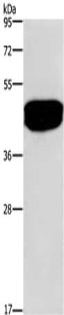 Gel: 8%SDS-PAGE,Lysate: 40 μg,,Primary antibody: SDCCAG3 Antibody(SDCCAG3 Antibody) at dilution 1/500 dilution,Secondary antibody: Goat anti rabbit IgG at 1/8000 dilution,Exposure time: 20 secondsRabbit anti-Human SDCCAG3 Polyclonal Antibody