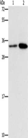 Gel: 15%SDS-PAGE, Lysate: 40 μg, Lane 1-2: Hela cells, A431 cells, Primary antibody: CDC34 Antibody(CDC34 Antibody) at dilution 1/900, Secondary antibody: Goat anti rabbit IgG at 1/8000 dilution, Exposure time: 1 minuteRabbit anti-Human CDC34 Polyclonal Antibody