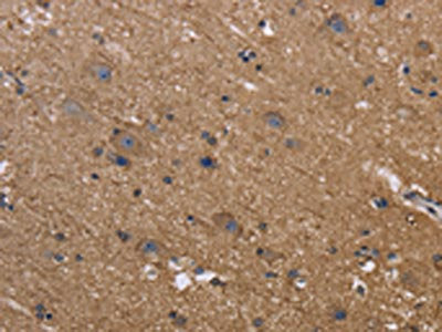 The image on the left is immunohistochemistry of paraffin-embedded Human brain  tissue using REL Antibody(REL Antibody) at dilution 1/50, on the right is treated with fusion protein. (Original magnification: ×200)Rabbit anti-Human REL Polyclonal Antibody