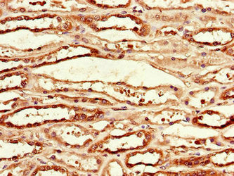 Immunohistochemistry of paraffin-embedded human kidney tissue using MCL1 Antibody at dilution of 1:100