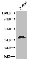 Western Blot | Positive WB detected in: Jurkat whole cell lysate | All lanes: MCL1 antibody at 3.2μg/ml | Secondary | Goat polyclonal to rabbit IgG at 1/50000 dilution | Predicted band size: 38, 29 kDa | Observed band size: 38 kDa
