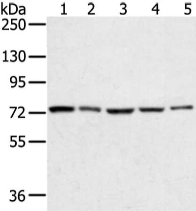 Gel: 6%SDS-PAGE, Lysate: 40 μg, Lane 1-5: Hela, lncap, skov3, 293T and TM4 cell, Primary antibody: TGM4 Antibody(TGM4 Antibody) at dilution 1/400 dilution, Secondary antibody: Goat anti rabbit IgG at 1/8000 dilution, Exposure time: 10 secondsRabbit anti-Human TGM4 Polyclonal Antibody
