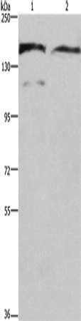 Gel: 6%SDS-PAGE, Lysate: 40 μg, Lane 1-2: 293T cells, human fetal brain tissue, Primary antibody: DCTN1 Antibody(DCTN1 Antibody) at dilution 1/200, Secondary antibody: Goat anti rabbit IgG at 1/8000 dilution, Exposure time: 20 secondsRabbit anti-Human DCTN1 Polyclonal Antibody