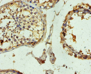 Immunohistochemistry of paraffin-embedded human testis tissue using TUBB3 Antibody at dilution of 1:100Rabbit anti-Human TUBB3 Polyclonal Antibody
