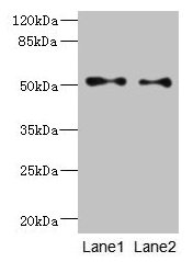 Western blot  | All lanes: TUBB3 antibody at 6µg/ml  | Lane 1: A549 whole cell lysate  | Lane 2: A431 whole cell lysate  | Secondary  | Goat polyclonal to rabbit IgG at 1/10000 dilution  | Predicted band size: 51, 43 kDa  | Observed band size: 51 kDaRabbit anti-Human TUBB3 Polyclonal Antibody