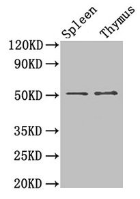 Western Blot  | Positive WB detected in: Mouse spleen tissue, Mouse thymus tissue  | All lanes: TUBB3 antibody at 1.5µg/ml  | Secondary  | Goat polyclonal to rabbit IgG at 1/50000 dilution  | Predicted band size: 51, 43 kDa  | Observed band size: 51 kDaRabbit anti-Human TUBB3 Polyclonal Antibody