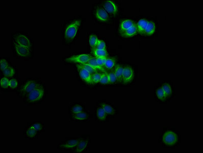 Immunofluorescent analysis of HepG2 cells using TUBB3 Antibody at dilution of 1:100 and Alexa Fluor 488-congugated AffiniPure Goat Anti-Rabbit IgG(H+L)Rabbit anti-Human TUBB3 Polyclonal Antibody