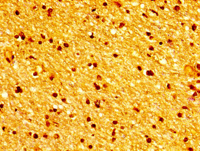 Immunohistochemistry of paraffin-embedded human brain tissue using TUBB3 Antibody at dilution of 1:100Rabbit anti-Human TUBB3 Polyclonal Antibody